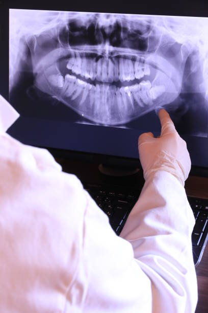Best Emergency Root Canal Therapy in Thomasboro, IL