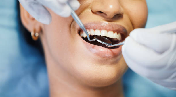 Best Emergency Cosmetic Dentistry (e.g., broken veneers) in Thomasboro, IL
