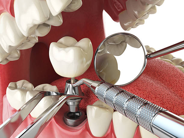 Best Emergency Orthodontic Repairs in Thomasboro, IL